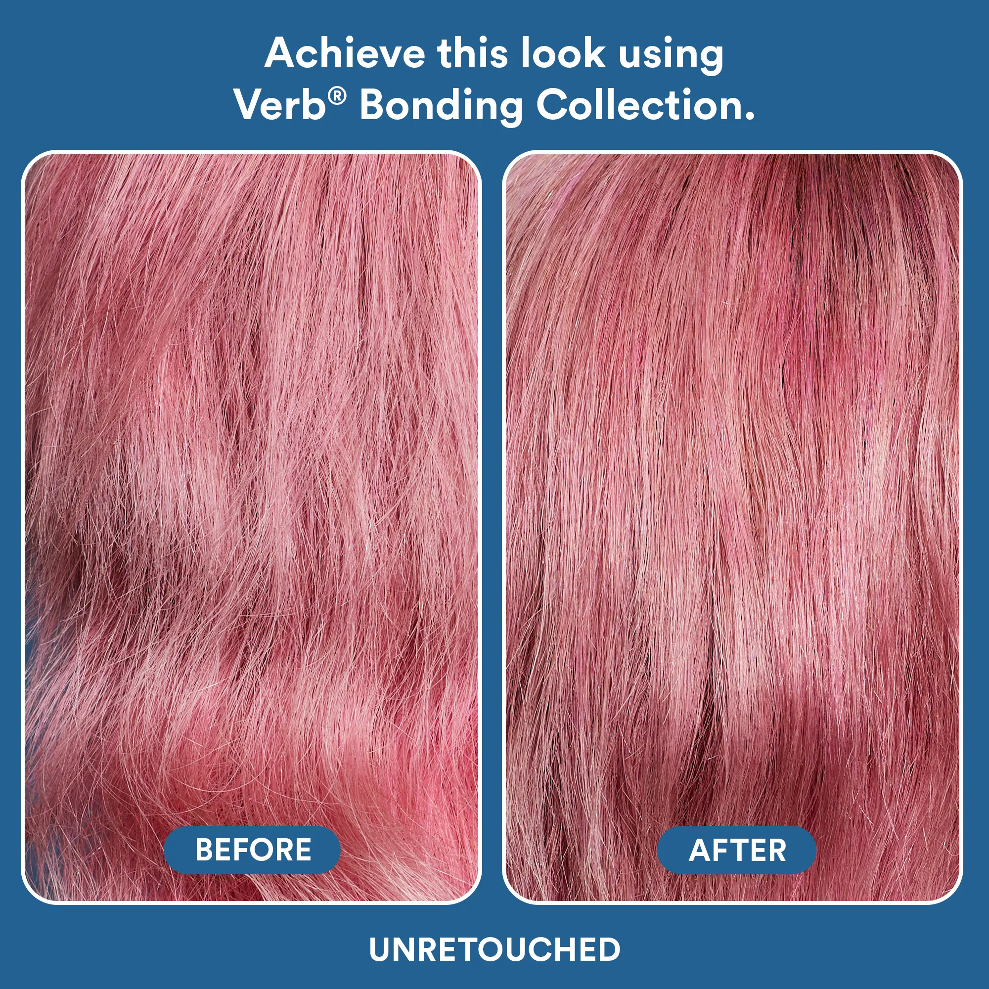 bonding mask - Image 7