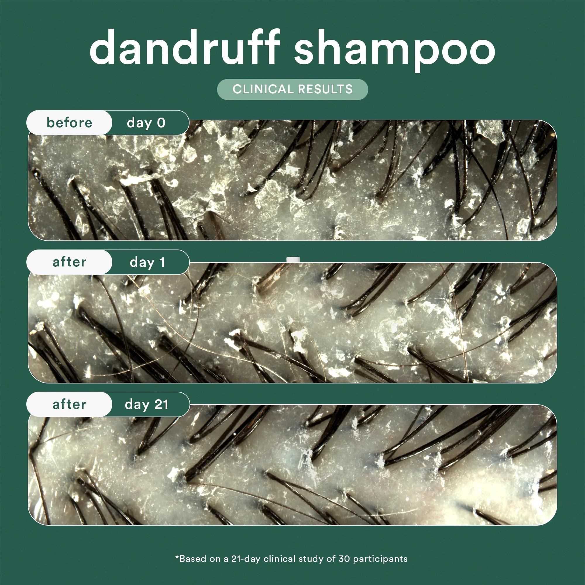 dandruff shampoo - Image 3