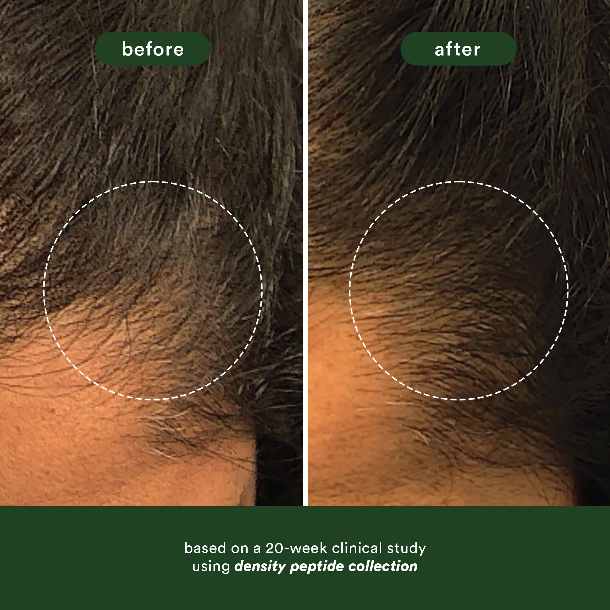 density peptide hair serum - Image 3