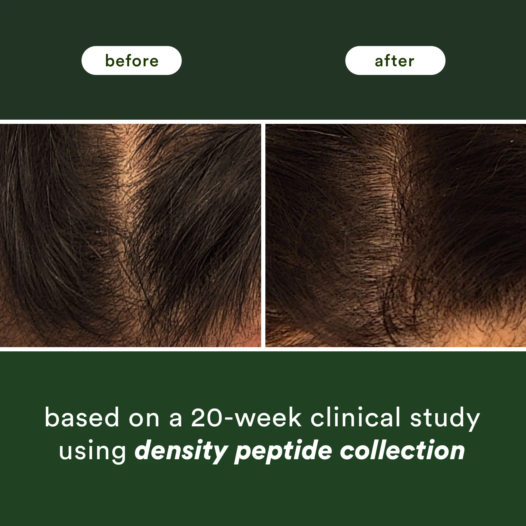 density peptide hair serum - Image 4